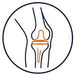 Knee Replacement