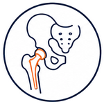 Knee Replacement