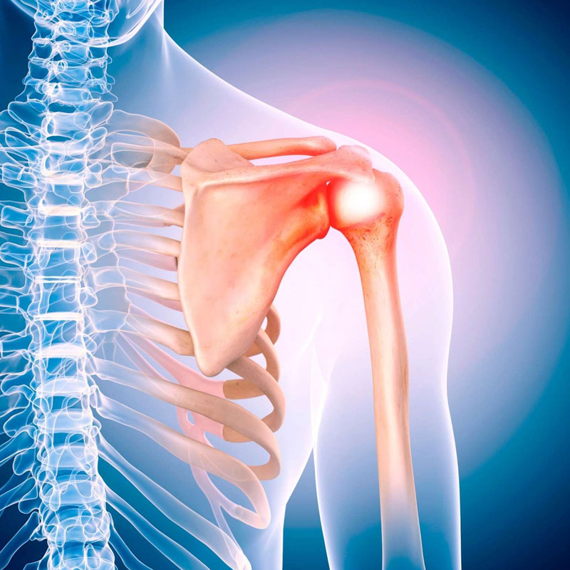 Joint Dislocation Treatment