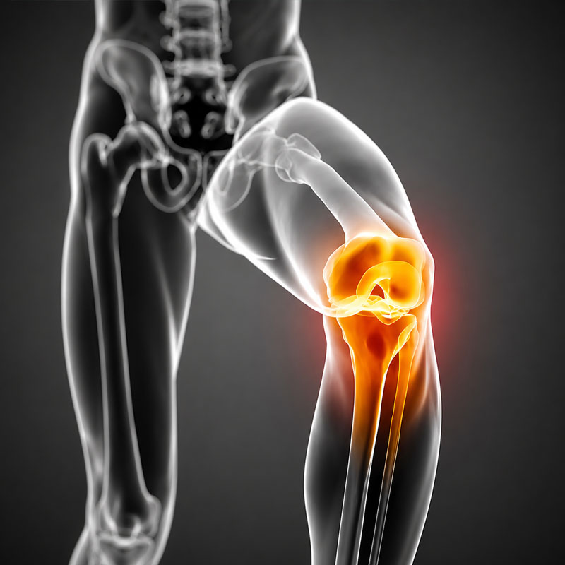 Knee Osteotomy