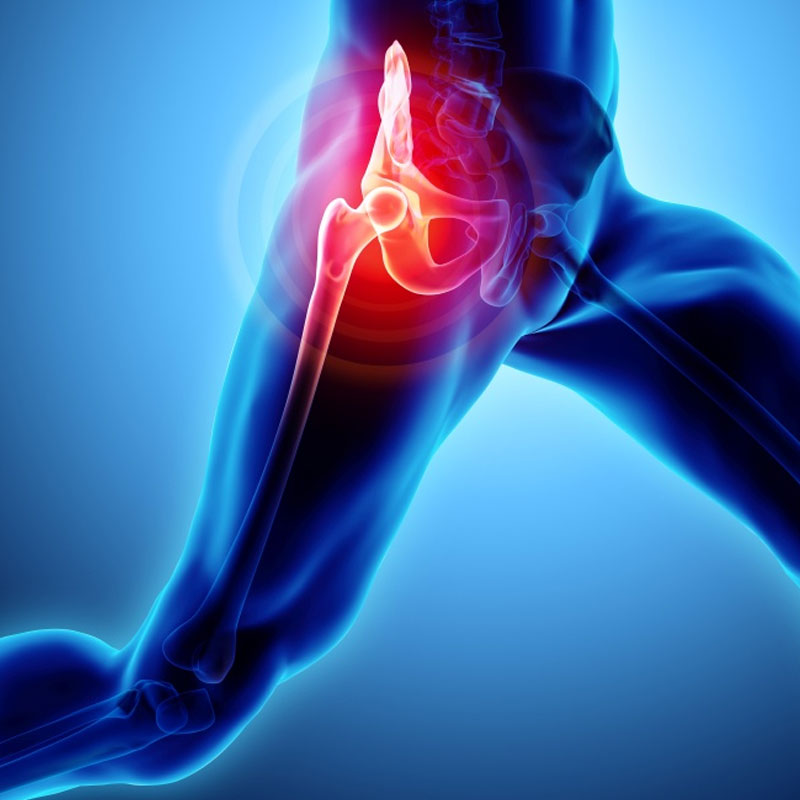 Primary Hip and Knee Arthroplasty