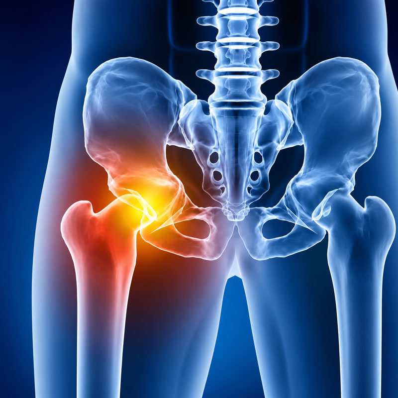 Minimally Invasive Hip Correction